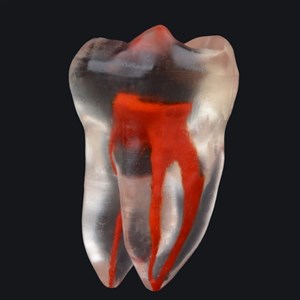 EndoPrep Kanallı Diş Alt Molar / 36 No